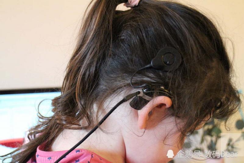 人工智能植入智能耳蜗 失聪儿童借助科技的力量回归正常生活