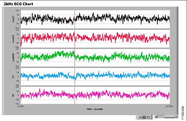 Screen shot of ADAS1000 noise measurement in lead mode using the ADAS1000 evaluation board and evaluation software