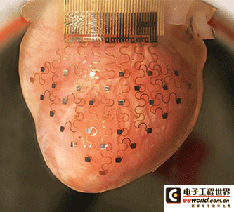 八大医疗科技技术盘点：仿生3D打印 柔性微电子等在列