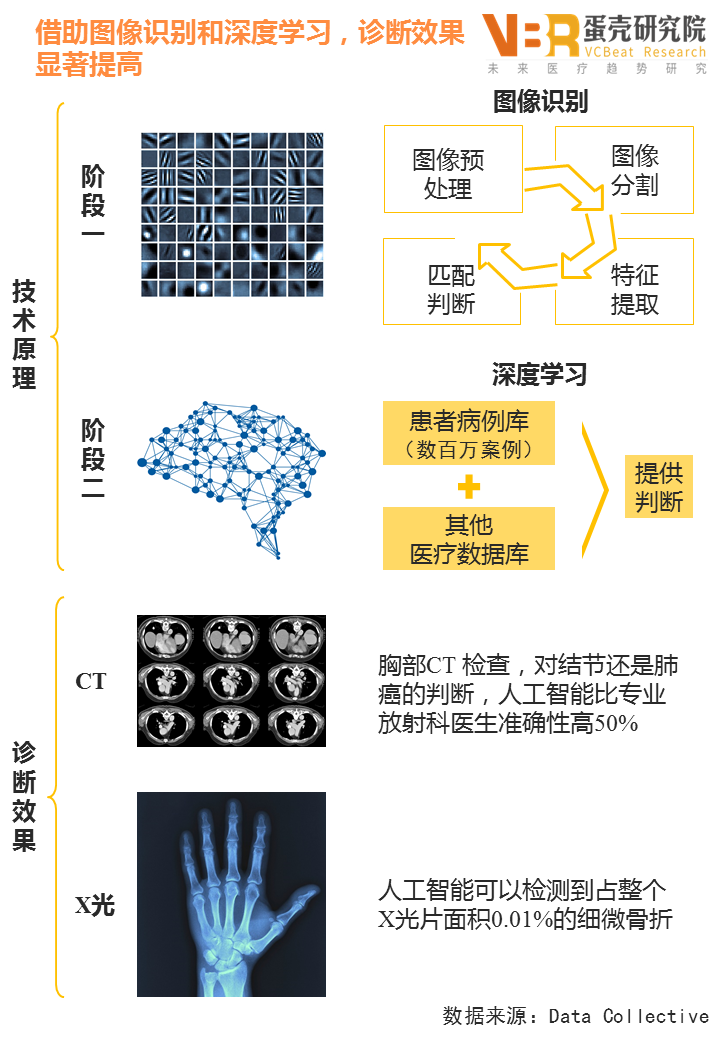 Application of artificial intelligence in medical imaging