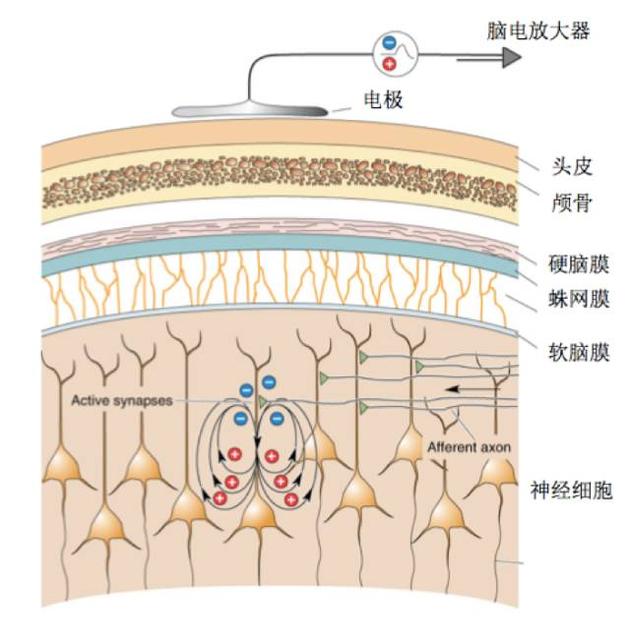 脑电产生的原理