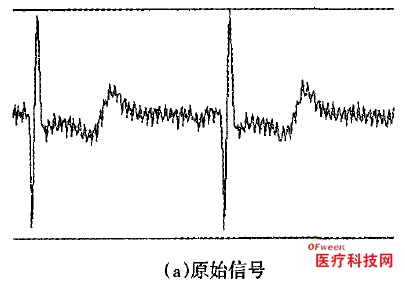 Design of ECG Detection System Based on USB Bus