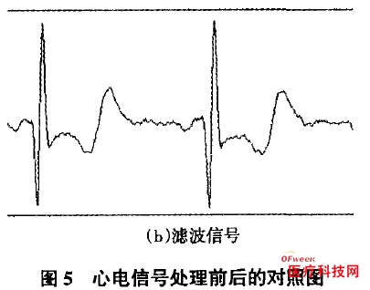 Design of ECG Detection System Based on USB Bus