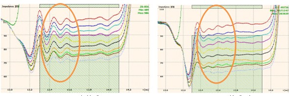 Application of Sequid TDR in PCB impedance testing in IoT devices