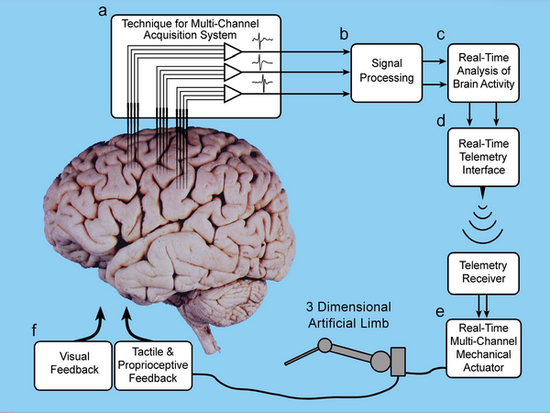 Brain-computer interface research pioneer: Musk's investment in brain-computer interface is marketing