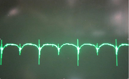 1519872805908344.png?imageView2/2/w/550 blob.png?imageView2/2/w/550