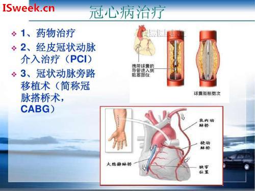 应用在静息心脏诊断冠状动脉狭窄的光纤压力传感器