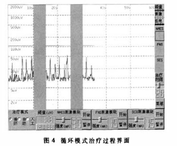 采用嵌入式ARM处理器设计便携式脑卒中康复仪
