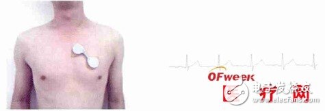 一种新型电极贴式无线低功耗动态心电记录仪的设计与实现过程