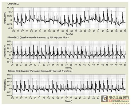 Design of ECG signal acquisition and analysis based on LabVIEW