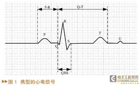 典型的心电信号